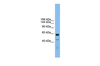UMODL1 Rabbit Polyclonal Antibody