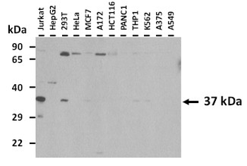 ASAHL Rabbit Polyclonal Antibody