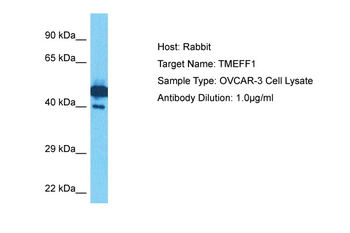 TMEFF1 Rabbit Polyclonal Antibody