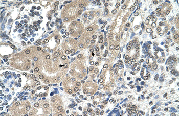 RRP1 Rabbit Polyclonal Antibody