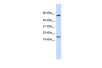 KRTAP11-1 Rabbit Polyclonal Antibody