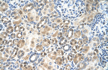 RFC5 Rabbit Polyclonal Antibody