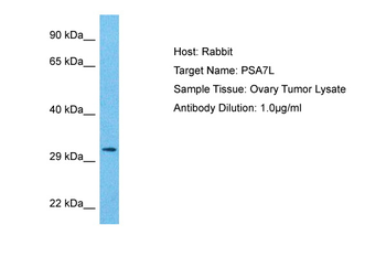 PSMA8 Rabbit Polyclonal Antibody