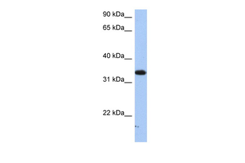 SULT6B1 Rabbit Polyclonal Antibody