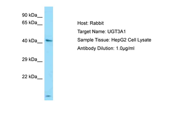 UGT3A1 Rabbit Polyclonal Antibody