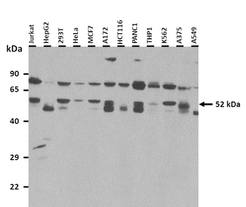 ST6GALNAC3 Rabbit Polyclonal Antibody