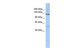 CHSY-2 Rabbit Polyclonal Antibody