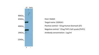 C20orf116 Rabbit Polyclonal Antibody