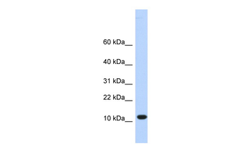 C10orf57 Rabbit Polyclonal Antibody