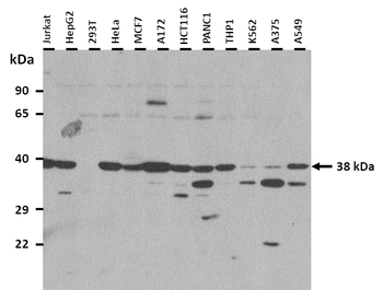 ST6GALNAC5 Rabbit Polyclonal Antibody