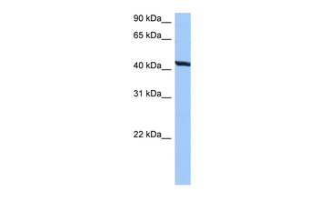 TMEM118 Rabbit Polyclonal Antibody