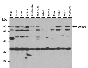 ELFN2 Rabbit Polyclonal Antibody
