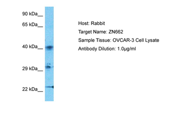 ZNF662 Rabbit Polyclonal Antibody
