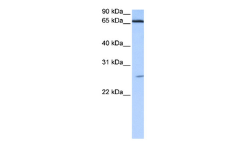 DKFZp686E2433 Rabbit Polyclonal Antibody