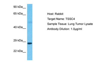 TSSC4 Rabbit Polyclonal Antibody