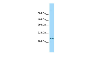 Dnalc4 Rabbit Polyclonal Antibody