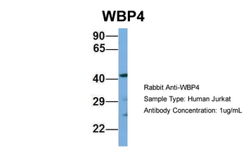 WBP4 Rabbit Polyclonal Antibody