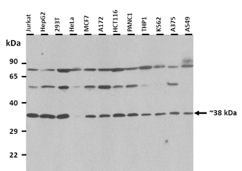 OSTalpha Rabbit Polyclonal Antibody