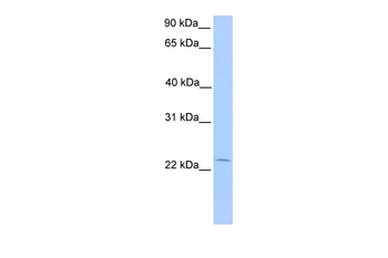 C5orf39 Rabbit Polyclonal Antibody