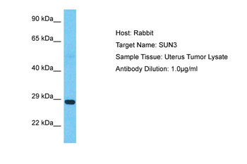 SUN3 Rabbit Polyclonal Antibody