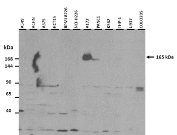 NLRP1 Rabbit Polyclonal Antibody