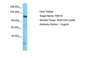 FBXO10 Rabbit Polyclonal Antibody