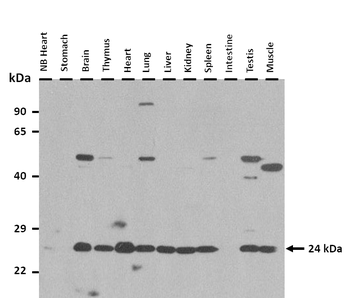 Snx10 Rabbit Polyclonal Antibody