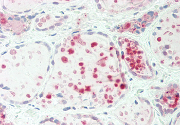 IARS Rabbit Polyclonal Antibody