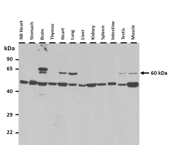 FLVCR1 Rabbit Polyclonal Antibody