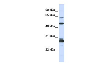 PES1 Rabbit Polyclonal Antibody