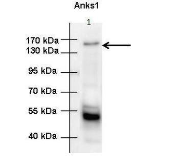 Anks1 Rabbit Polyclonal Antibody