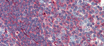PHACTR1 Rabbit Polyclonal Antibody