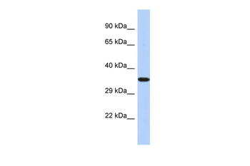 EPHX4 Rabbit Polyclonal Antibody