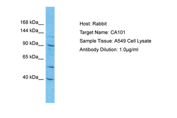 CATSPERE Rabbit Polyclonal Antibody