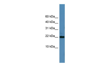 SFRS12IP1 Rabbit Polyclonal Antibody