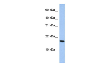 ARL5A Rabbit Polyclonal Antibody
