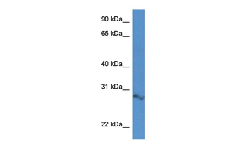 Arpin Rabbit Polyclonal Antibody