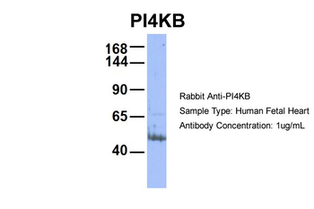 PI4KB Rabbit Polyclonal Antibody