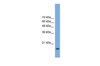 POP5 Rabbit Polyclonal Antibody