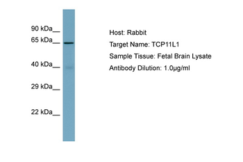 TCP11L1 Rabbit Polyclonal Antibody