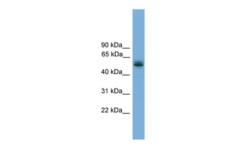 CCDC76 Rabbit Polyclonal Antibody