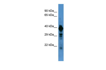SLC18A1 Rabbit Polyclonal Antibody