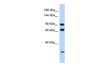 ARMC4 Rabbit Polyclonal Antibody