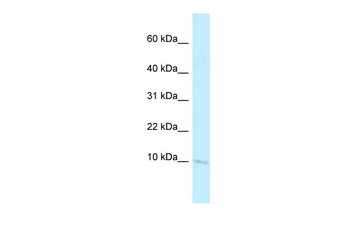 Banf2 Rabbit Polyclonal Antibody