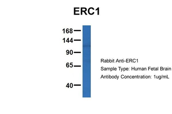 ERC1 Rabbit Polyclonal Antibody