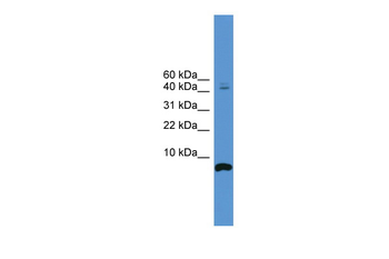 CORT Rabbit Polyclonal Antibody