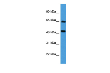 COL8A2 Rabbit Polyclonal Antibody