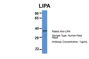 LIPA Rabbit Polyclonal Antibody
