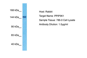 PPIP5K1 Rabbit Polyclonal Antibody