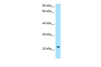 SLC50A1 Rabbit Polyclonal Antibody